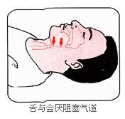 太阳集团